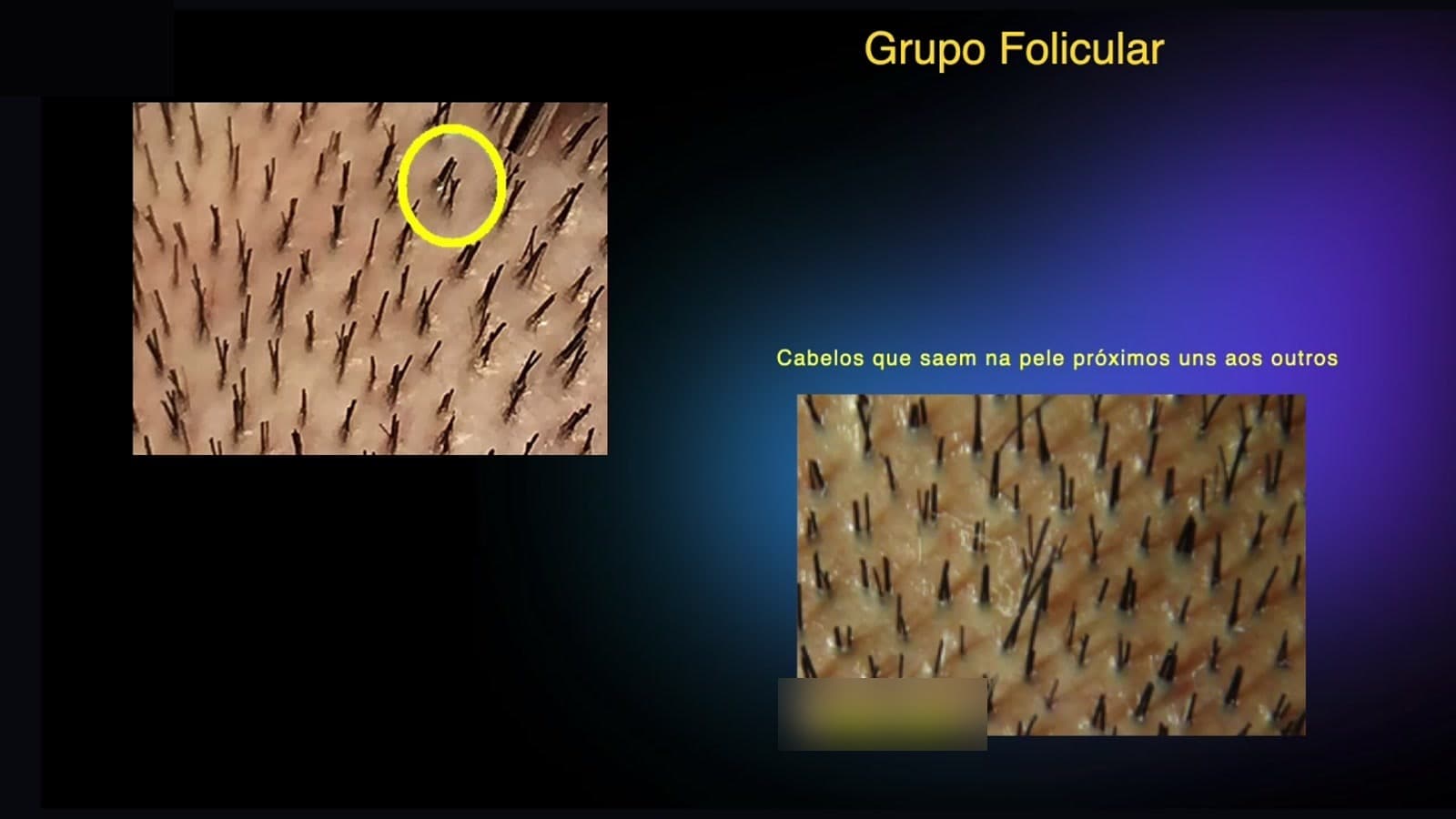 Slide da aula: grupos foliculares na pele